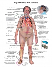 hebert-body-map